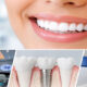 cosmetic dental clinic Dubai